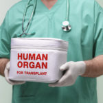 transplant purposes