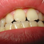 Orthodontist Melbourne