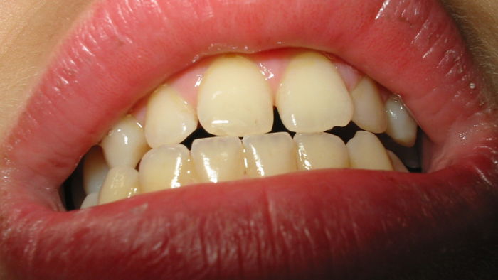 Orthodontist Melbourne
