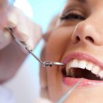 Teeth Veneers Gold Coast