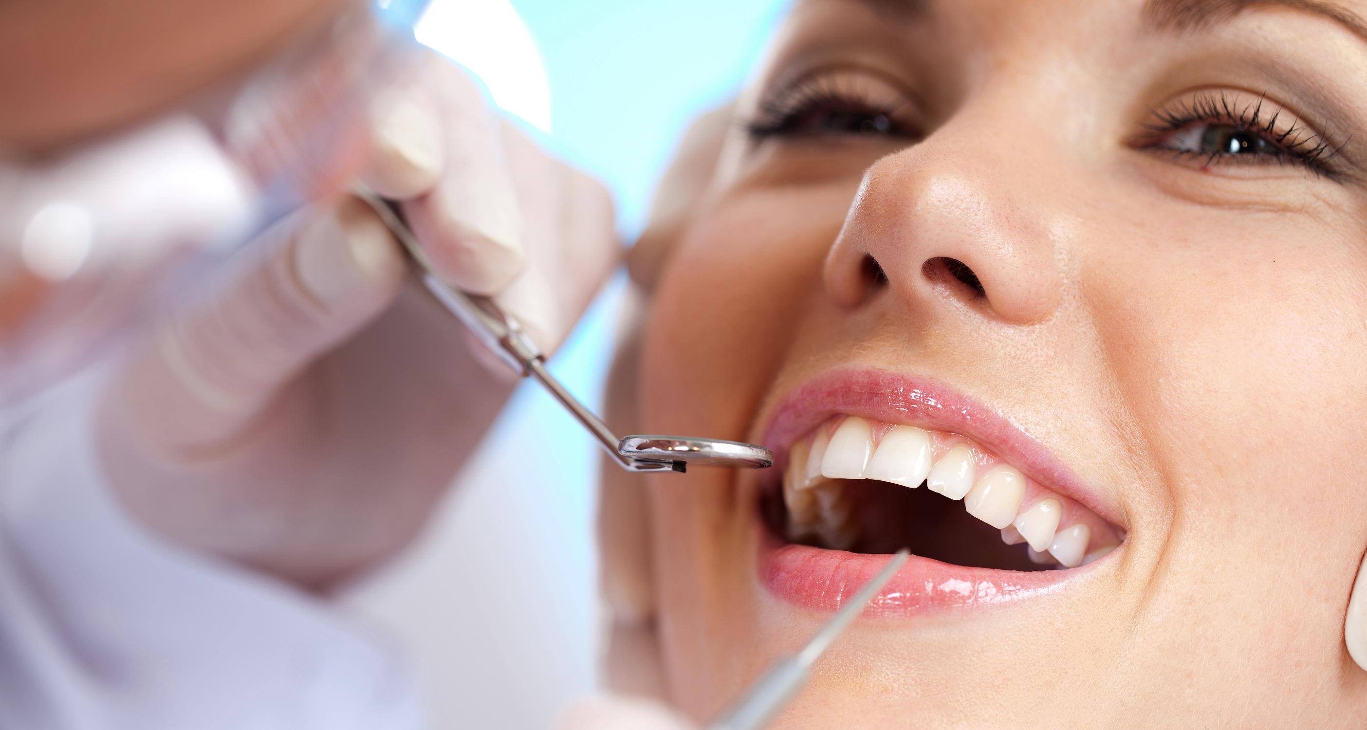 Teeth Veneers Gold Coast
