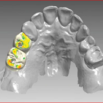 Digital Marketing for Dentists
