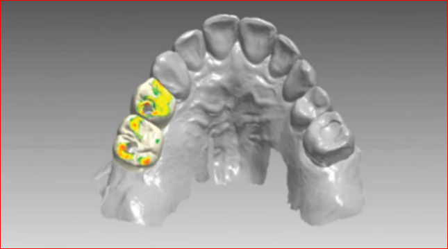 Digital Marketing for Dentists