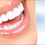 Cosmetic Dentist Newcastle