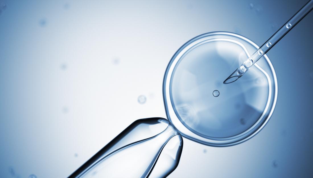 artificial Insemination process