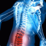 lower back pain treatment Brisbane