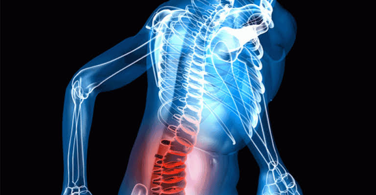 lower back pain treatment Brisbane