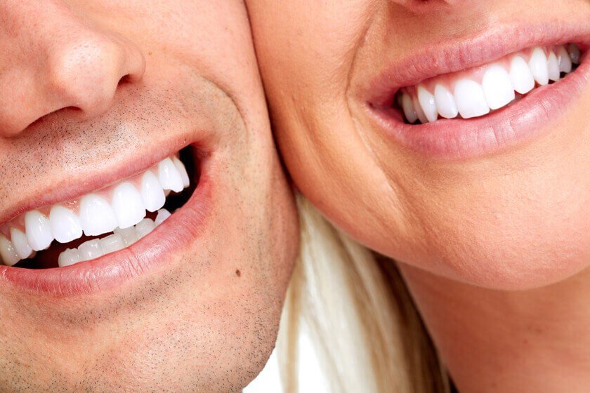 Dental Implants