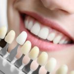 cosmetic dentist Liverpool