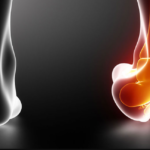 Ankle sprains treatment