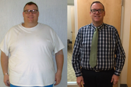 Gastric sleeve reviews