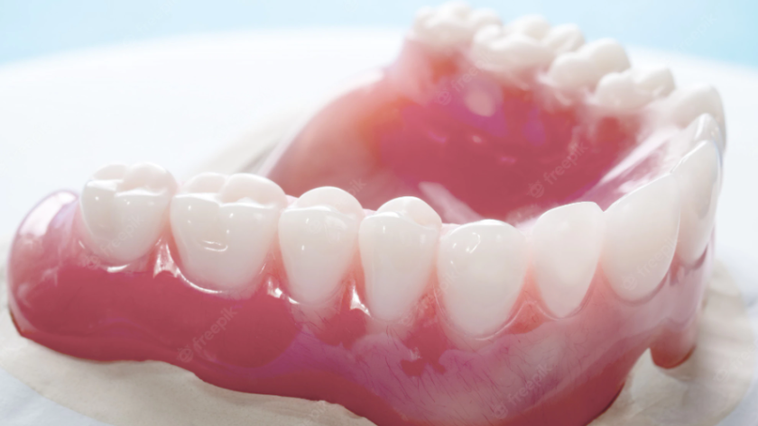 dental implants in northern rivers