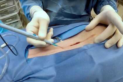 electrosurgical instruments