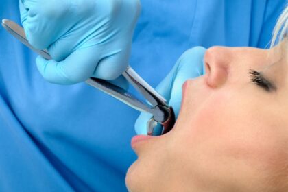 emergency tooth removal