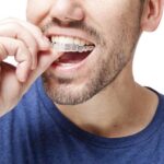 invisalign treatment