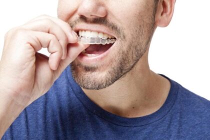invisalign treatment