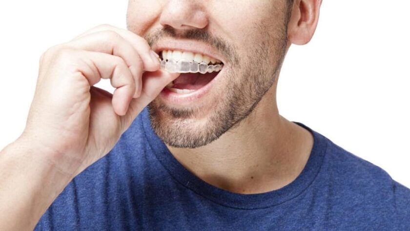 invisalign treatment
