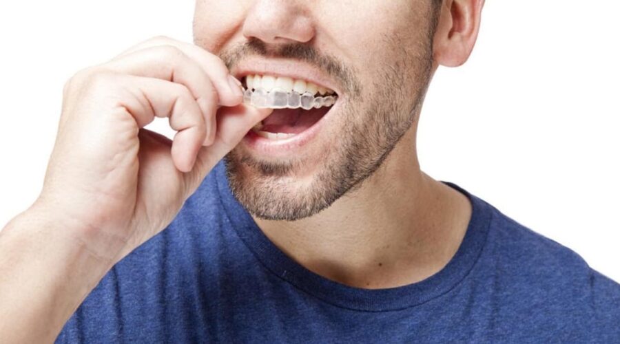 invisalign treatment