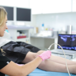 varicose vein treatment