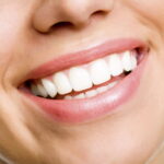 teeth whitening in Greensboro NC