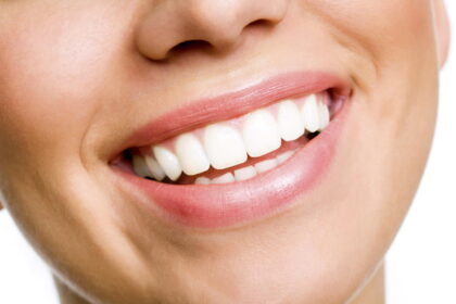 teeth whitening in Greensboro NC