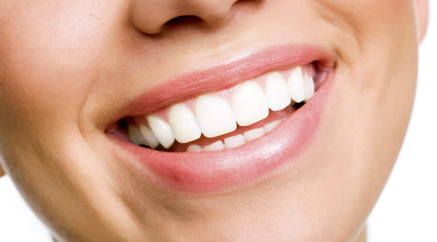 teeth whitening in Greensboro NC