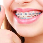 orthodontist services in Duncan