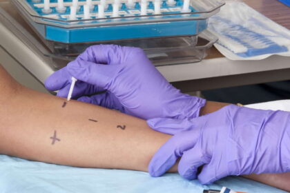 penicillin allergy de-labelling