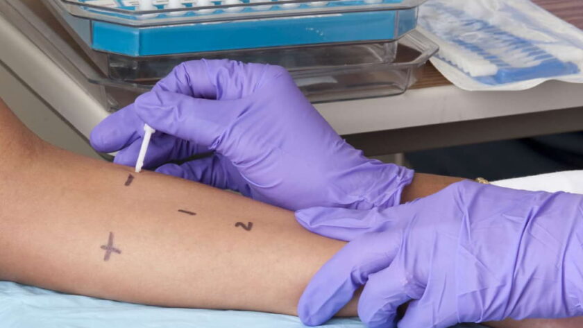 penicillin allergy de-labelling