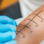 where to get a penicillin allergy test