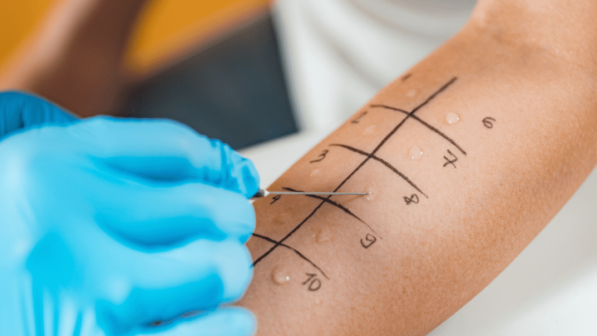 where to get a penicillin allergy test