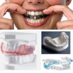 dental appliances for sleep apnea