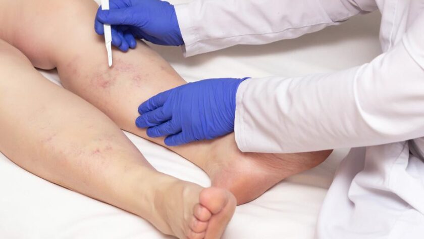vein doctors in Sydney